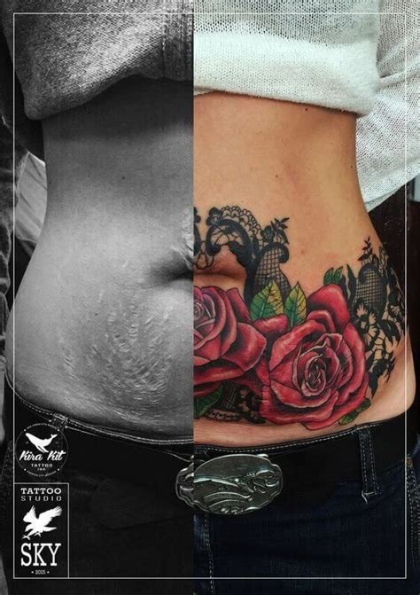 Tattoo over stretch marks. Things To Know About Tattoo over stretch marks. 